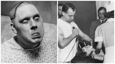 Lobotomiya - tibb tarixinin rüsvayçılığı