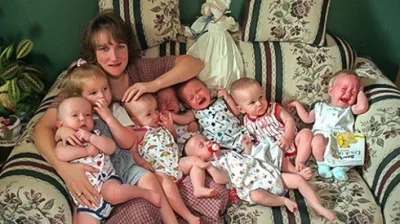 Dünyanın yaşayan ilk yeddizlərinin həyat hekayəsi