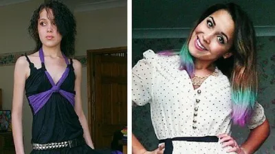 'Sən bir əşya deyilsən': Anoreksiyadan xilas olan gənc qadın başqalarına nümunə olur.