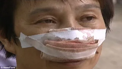 Çində qəzəbli kişi keçmiş həyat yoldaşının burnunu qopartdı