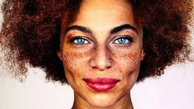 Fotolarına çilli üzlərin bənzərsiz gözəlliyini yansıdan Fotoqraf