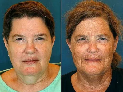 Siqarət çəkən ilə çəkməyən Әkizlər arasında fərqləri göstərən 10 Foto