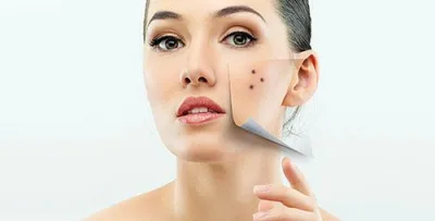 Üzdə olan xalların mənası