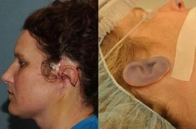 Qolda qulaq (Fotolar)